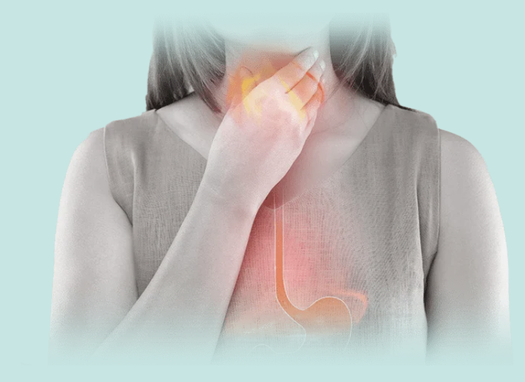 7 melhores remédios para refluxo